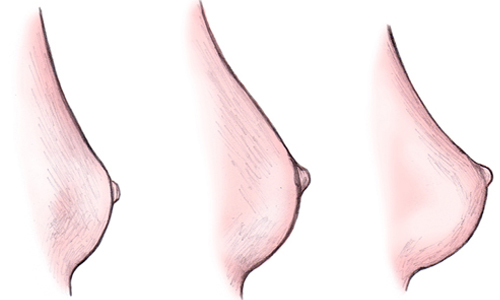 Breast Development in Nagpur